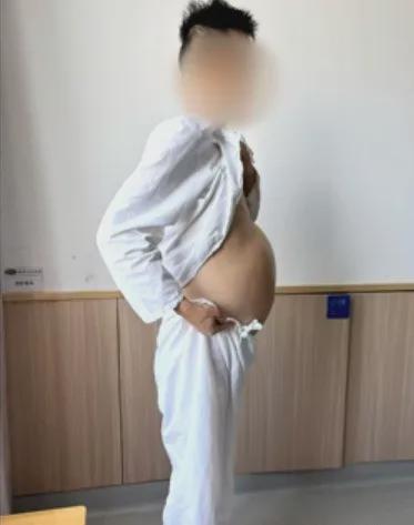 赚配网 男子4个月没大便，肚子胀如十月孕妇！医生开腹掏出2米“巨蟒”